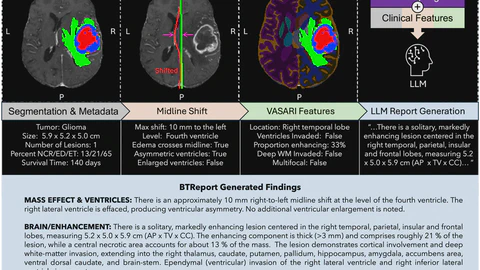BTReport: A Framework for Brain Tumor Radiology Report Generation with Clinically Relevant Features