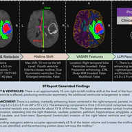 BTReport: A Framework for Brain Tumor Radiology Report Generation with Clinically Relevant Features