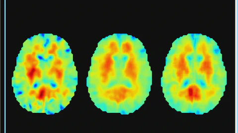 Real-time nonlinear inversion of magnetic resonance elastography with operator learning