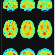 Real-time nonlinear inversion of magnetic resonance elastography with operator learning